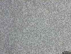 SARAMET microstructure